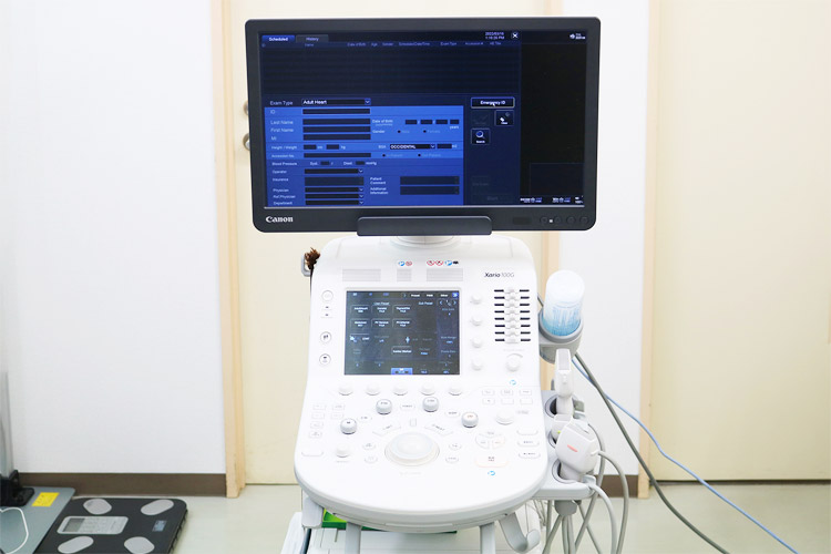 超音波診断装置